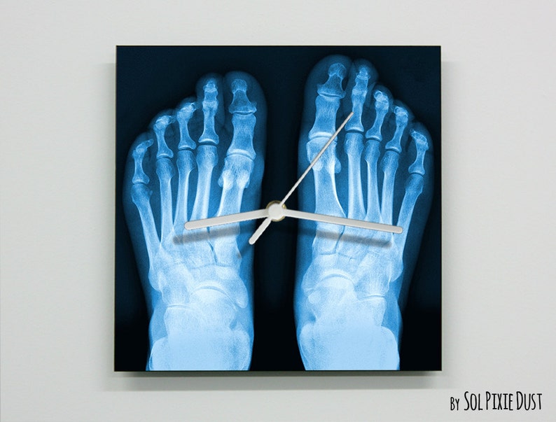 X-Ray Foot Wall Clock image 1