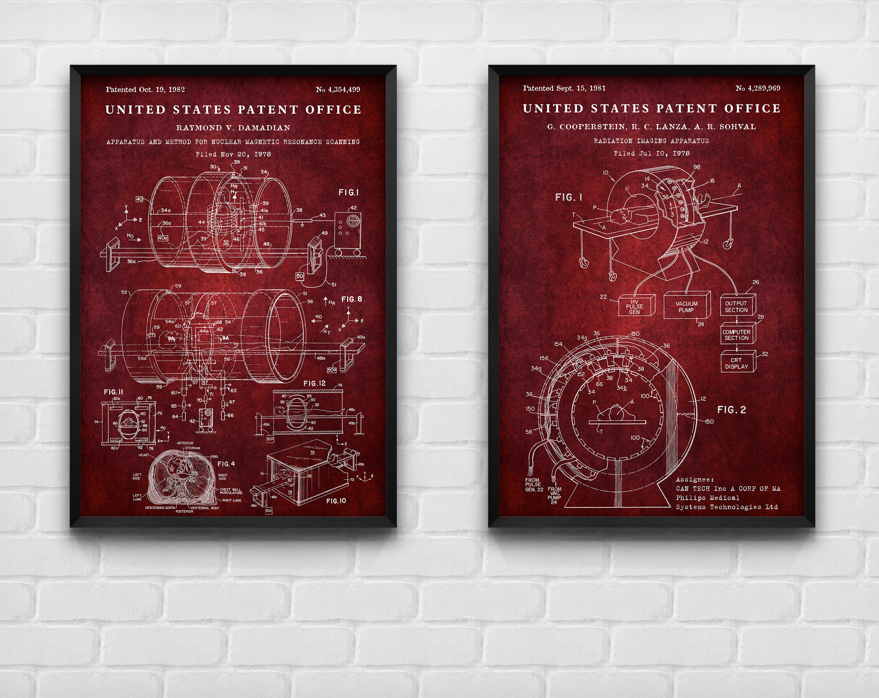 MRI & CT Scan Machine Patent Wall Art, X-ray Diagnostics Inventions ...