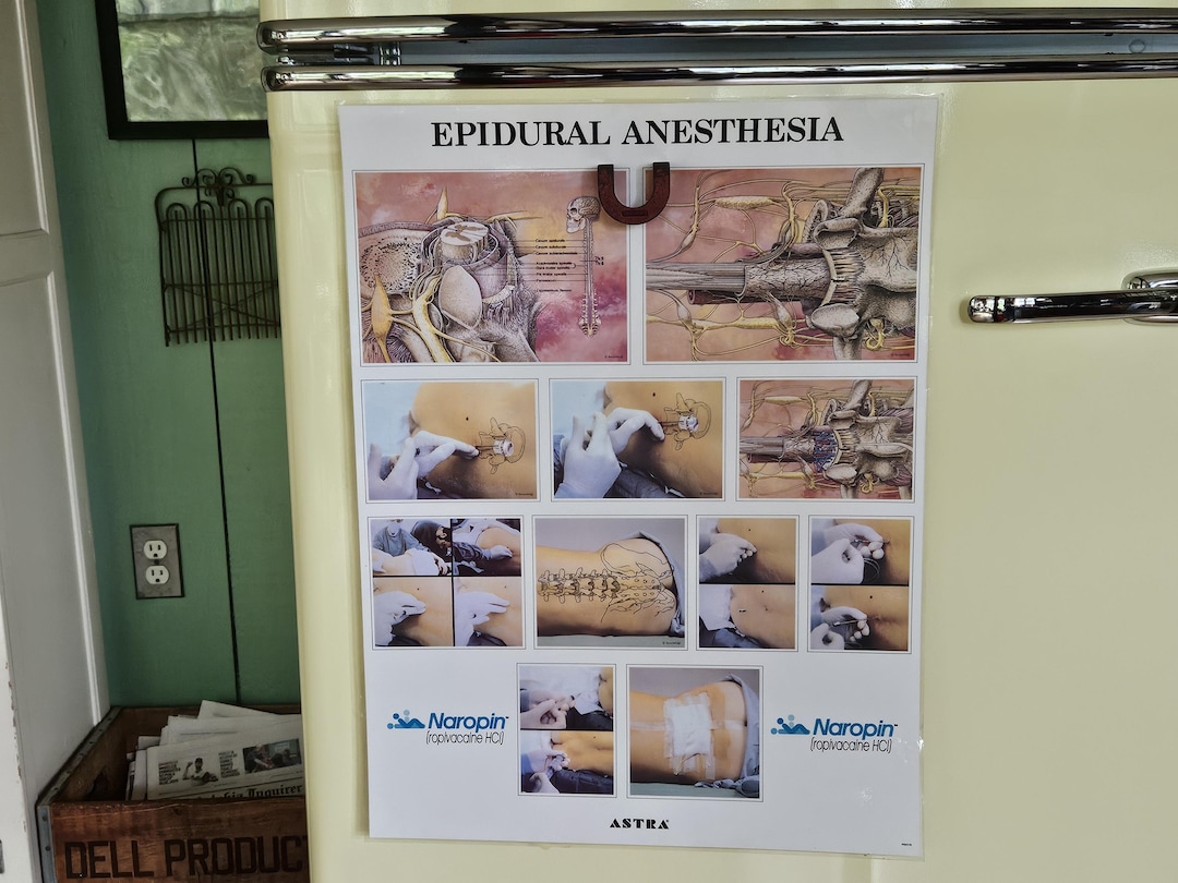 Vintage Authentic Large Epidural Anesthesia Poster, Plastic Laminated ...