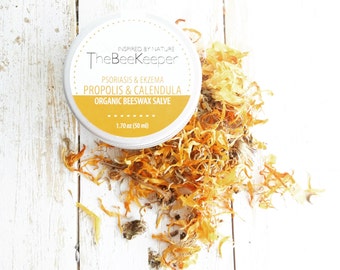 Eczema Salve, Psoriasis Salve, Eczema Remedy, Psoriasis Remedy, Hemp Seed Salve, Herbal Salve, Skin Irritations Salve, Organic Salve