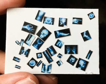 1:48 Miniature X-Ray Lot