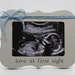 see more listings in the Baby/Ultrasound section