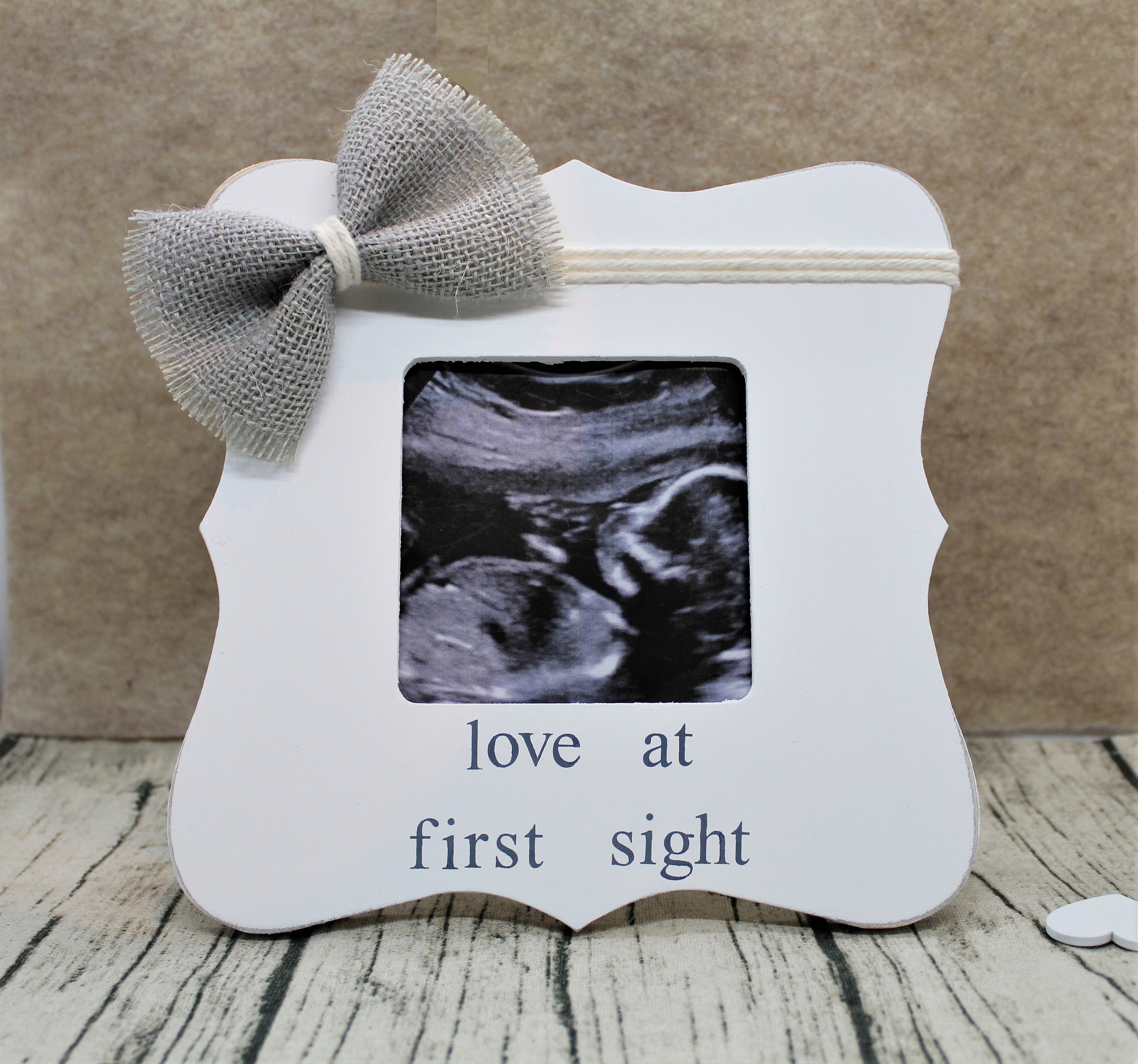 Ultrasound frame Etsy