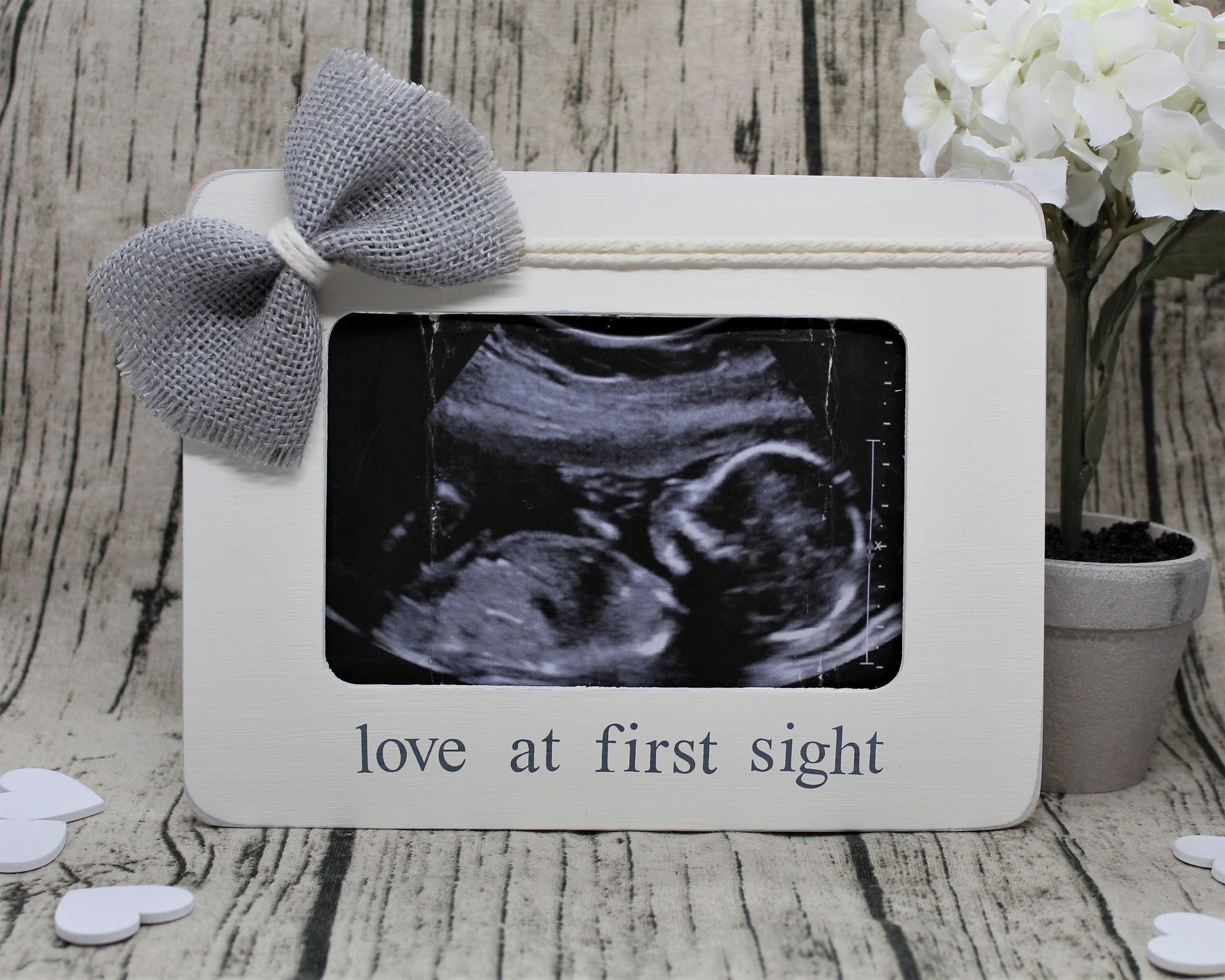 Ultrasound frame love at first sight