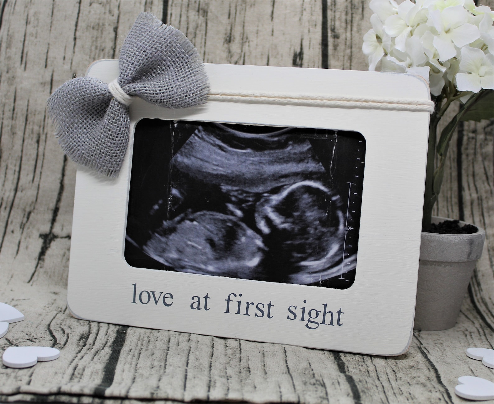 Ultrasound Frame Etsy