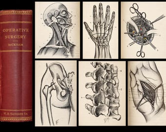 Operative Surgery - 1908 - 854 illustrations - Extensive Look at Surgical Techniques and Commentary -  1206 Pages.