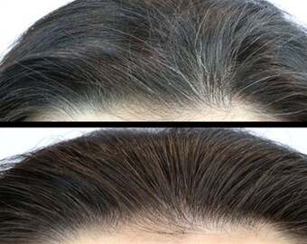Al-Shaafi Hair Blackening Oil for Grey Hair to Turn Black or Darker Color with Herbs & Seeds oil (4 oz fl) 60Days Money Back Guarantee