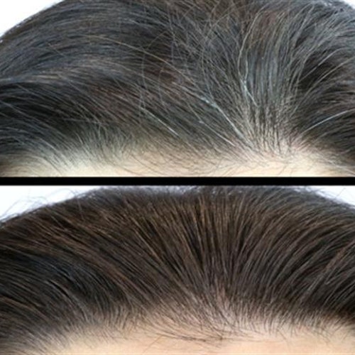 Blackening Hair Oil for Grey Hair to Turn Black Ordarker Color - Etsy Blackening Hair Oil for Grey Hair to Turn Black Ordarker Color - Etsy