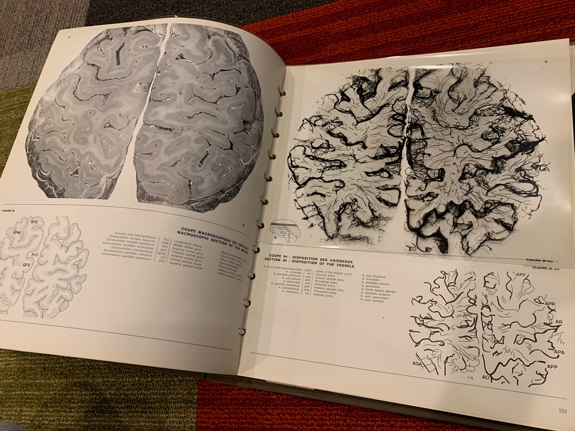Atlas de la vascularisation arterielle du cerveau chez l