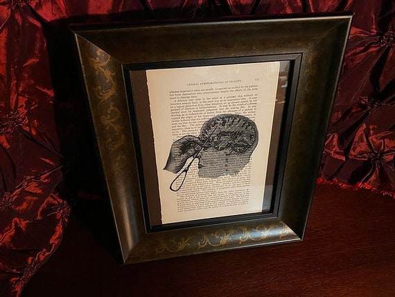 Framed Transorbital Lobotomy Print Etsy Uk Framed Transorbital Lobotomy Print Etsy Uk