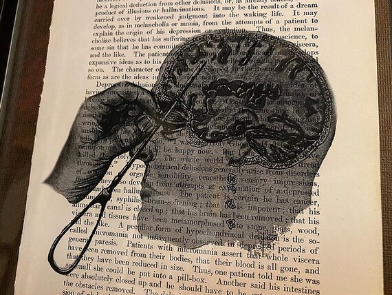 Framed Transorbital Lobotomy Print Etsy Australia Framed Transorbital Lobotomy Print Etsy Australia