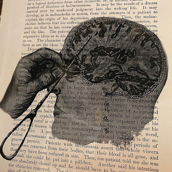 Home Lobotomy Kit Etsy