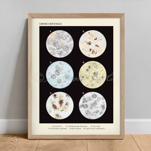 Crystals in Urine Collection Vintage Veterinary Art Print, Science Urology poster, Microbiology Wall Art