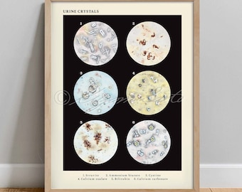 Crystals in Urine Collection Vintage Veterinary Art Print, Science Urology poster, Microbiology Wall Art