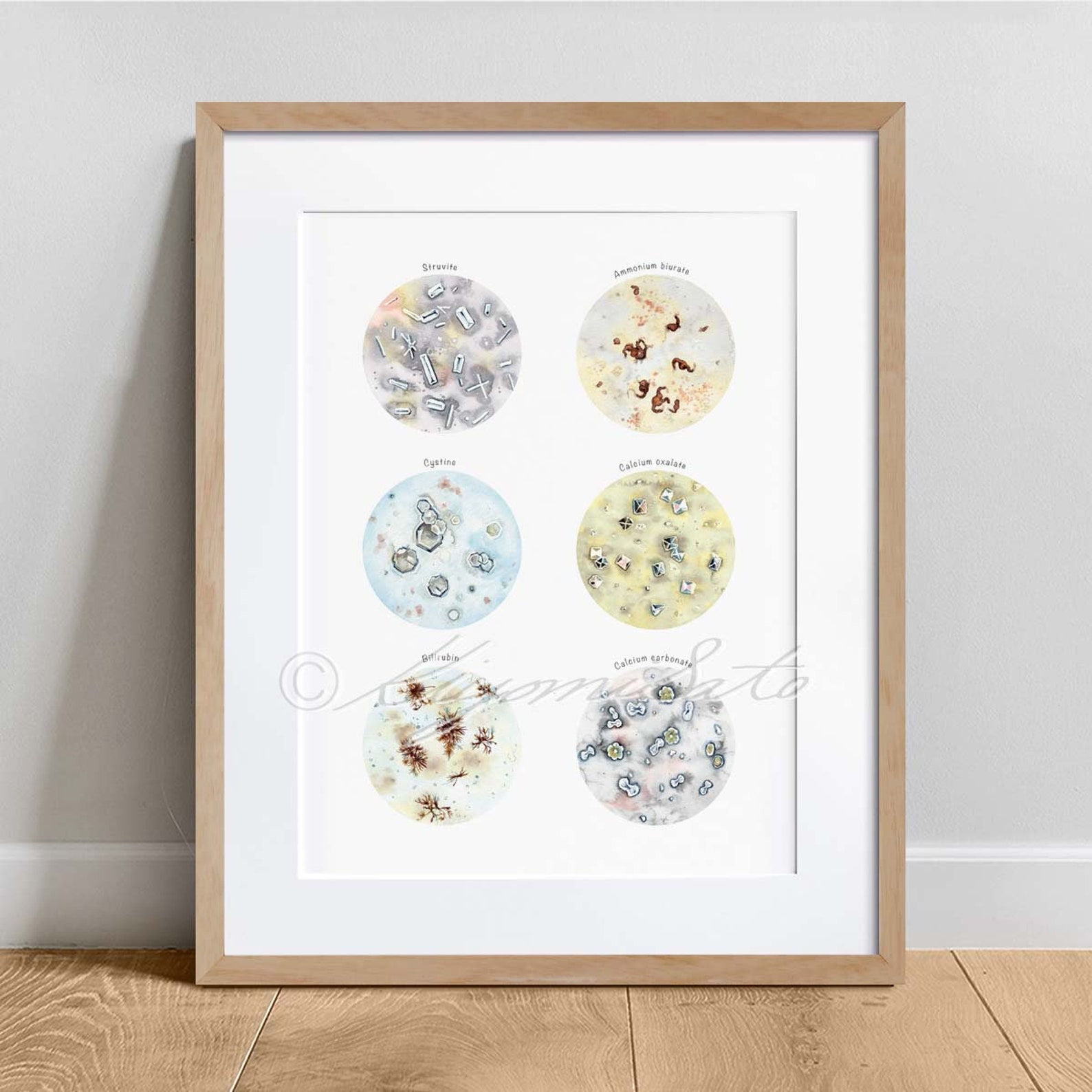 Crystals in Urine Collection Veterinary Art Print Science Etsy