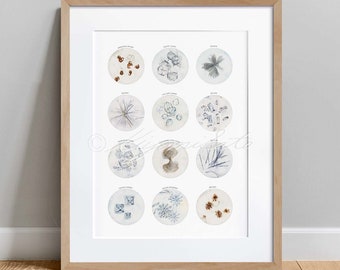 Crystals in Human Urine Collection, Science Art Poster, Urology Art, Microbiology Wall decor Print Art, Urologist Gift