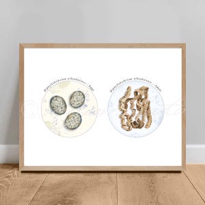 May include: A scientific illustration of the Diphyllobothrium nihonkaiense parasite. The image shows the eggs and adult form of the parasite. The eggs are depicted as three round, light brown objects with a darker brown center. The adult form is shown as a long, thin, light brown worm with a segmented body.
