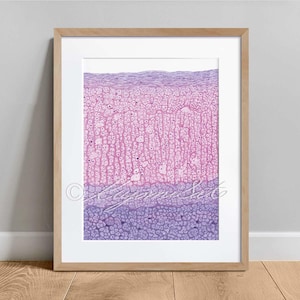 May include: Microscopic image of a cross-section of a human ovary. The image shows the outer layer of the ovary, the cortex, which contains follicles, and the inner layer, the medulla, which contains blood vessels and nerves.