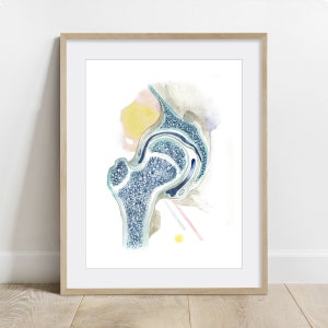 May include: A watercolor illustration of a human hip joint, showing the bone structure and cartilage. The illustration is in shades of blue, green, and brown, with a light pink and yellow watercolor background.