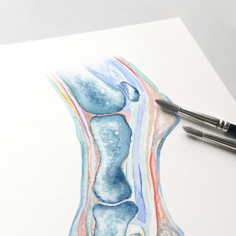 May include: A watercolor illustration of a cross-section of a human leg, showing the bones and surrounding tissues in shades of blue, pink, and purple.