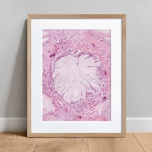 Gout Histopathology Art Poster, Histology Art, Science Art Decor Poster