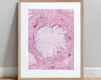 Gout Histopathology Art Poster, Histology Art, Science Art Decor Poster