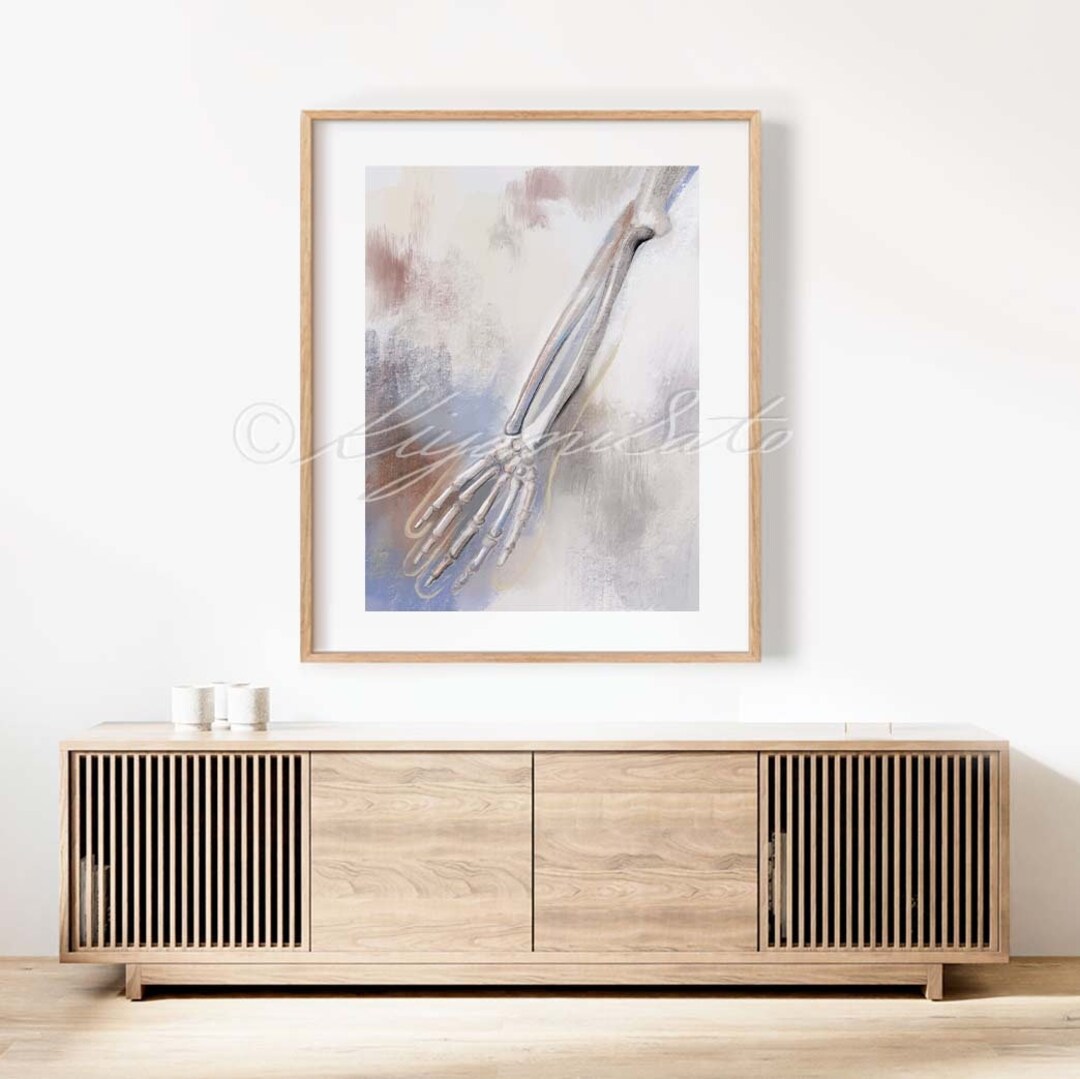 Arm Bones Abstract Art Rust Color Orthopedics Art Poster, Physical ...
