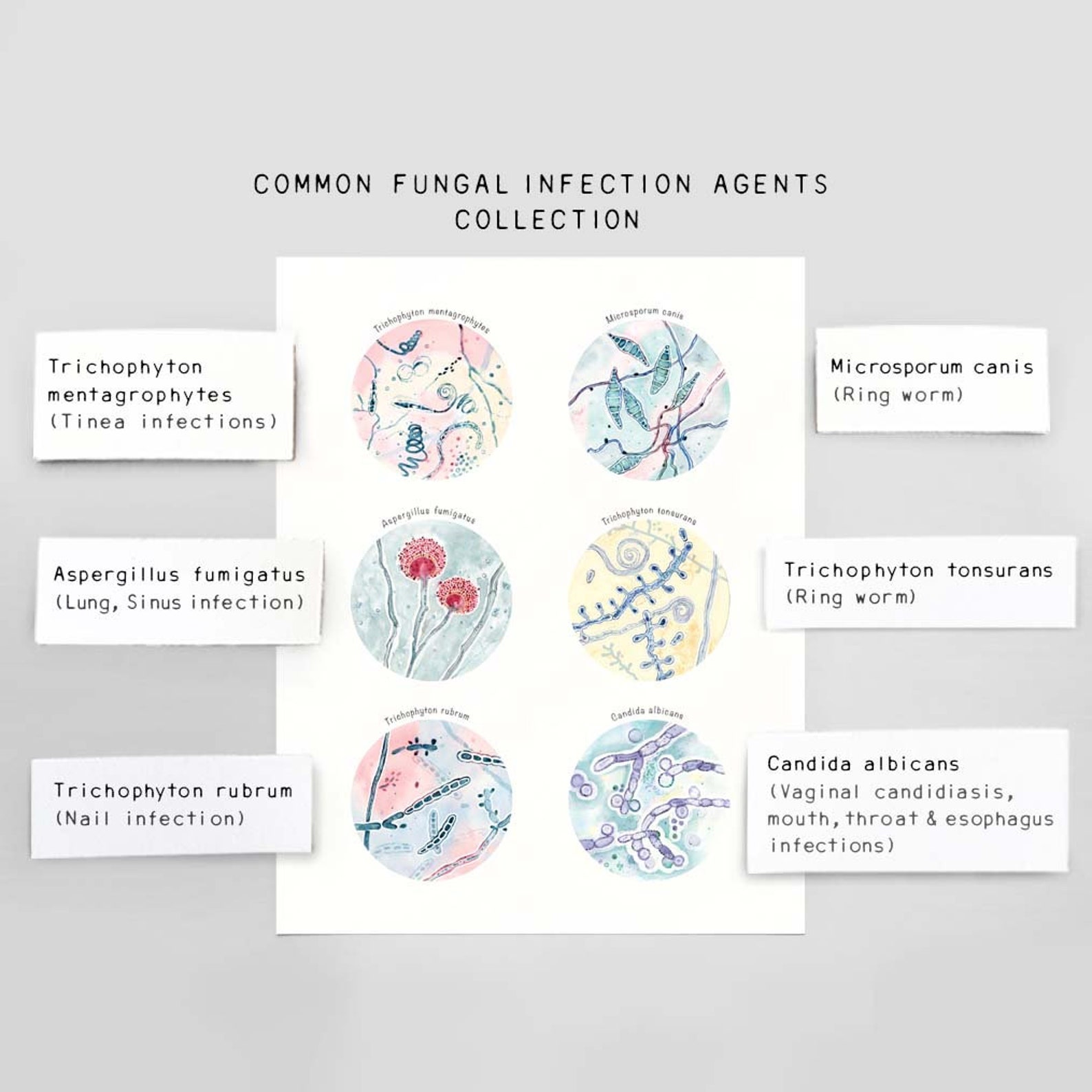 Common Fungal Infection Agents Collection Art Print, Science Poster ...