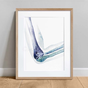 Elbow Bones Orthopedics Art Poster, Physical Therapy Art Poster Watercolor Anatomy Art Decor