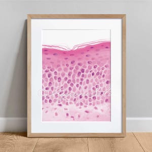 Parakeratosis pathology Art Print, Dermatology Histology Wall Art Poster, Skin Anatomy Science Art Poster