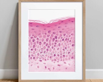 Parakeratosis pathology Art Print, Dermatology Histology Wall Art Poster, Skin Anatomy Science Art Poster