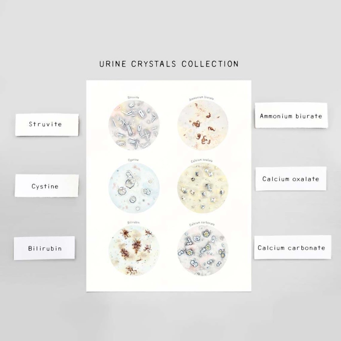Crystals in Urine Collection Veterinary Art Print Science Etsy