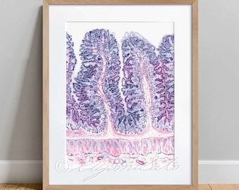 May include: A close-up microscopic image of intestinal tissue. The image shows the villi, which are finger-like projections that increase the surface area of the small intestine for absorption of nutrients. The villi are stained in shades of purple and pink.