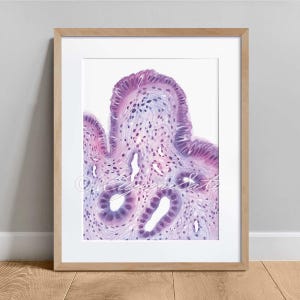 Stomach mucosa histology art print, Science Art Decor, Anatomy Poster, Pathology Art Print