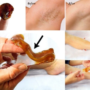 A collage showing the before and after results of a sugaring treatment, with a close-up view of the application and removal process.