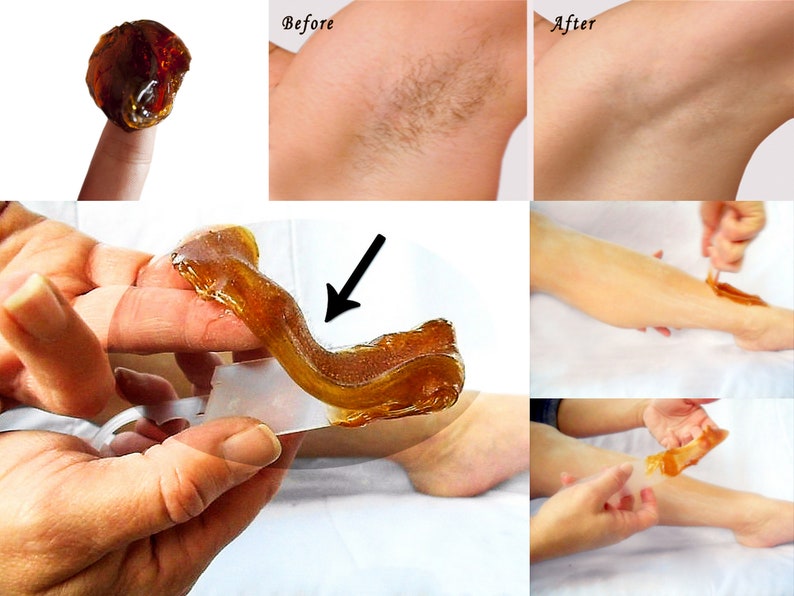 A collage showing the before and after results of a sugaring treatment, with a close-up view of the application and removal process.