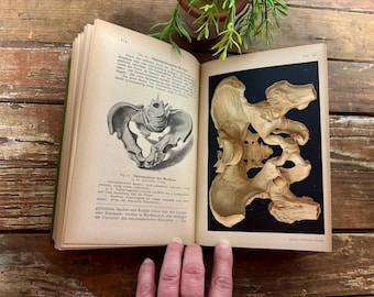 Antique 1897 German Medical Book.... "Pathologische Anatomie". Anatomy. Medicine. Diseases. Treatments. Illustrated. Medical Oddities.