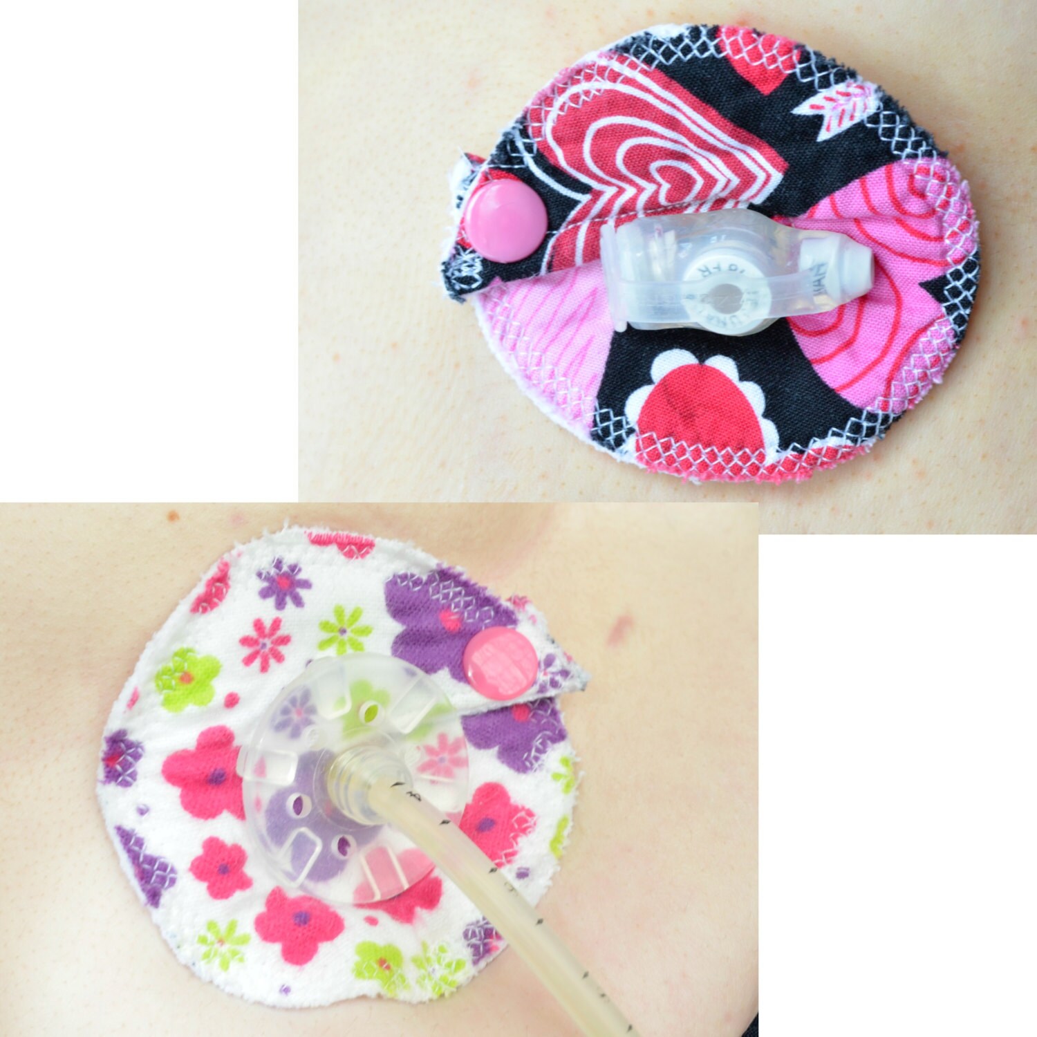 Feeding Tube Pads/cover Set of 5 Pads and 1 Reversible Tube Etsy