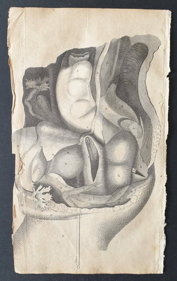 Original 1807 Andrew Fyfe Anatomical print - Gives a Side View of the Contents of the Young Female