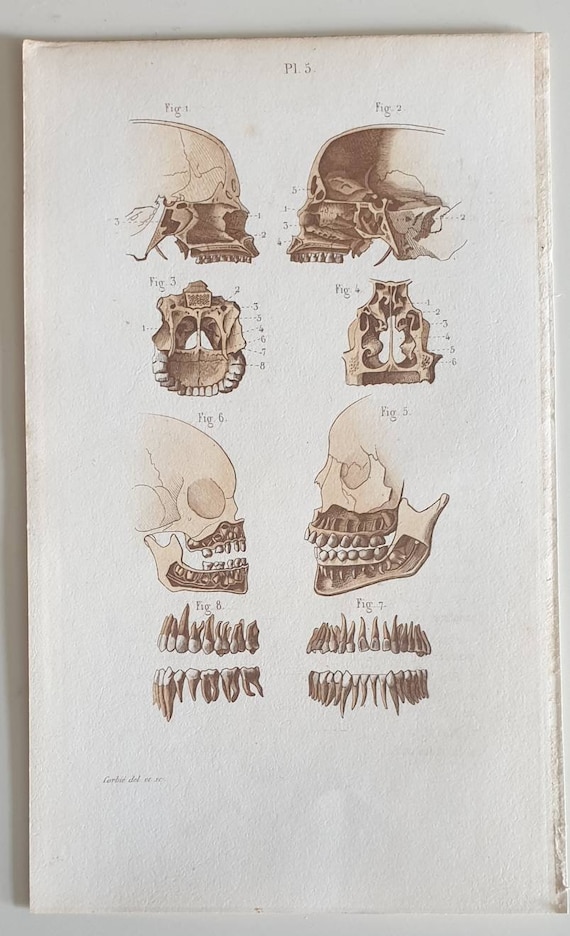 Original 1873 anatomical lithograph prints - Bones