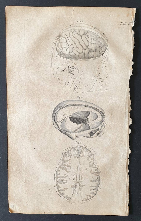 Original 1807 Andrew Fyfe Anatomical print - Views of the Brain and its Membranes