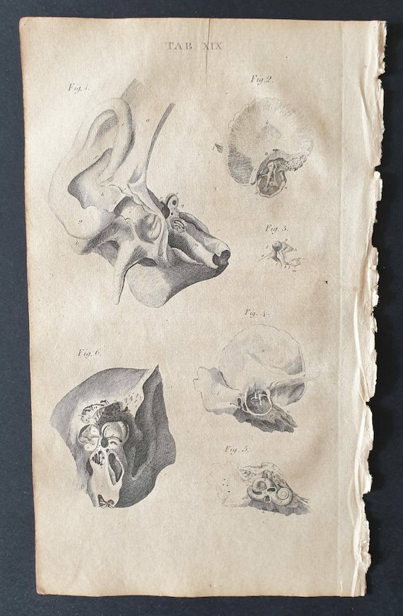Original 1807 Andrew Fyfe Anatomical print - Views of the Ear. All the Figures belong to the Right Side of the Head