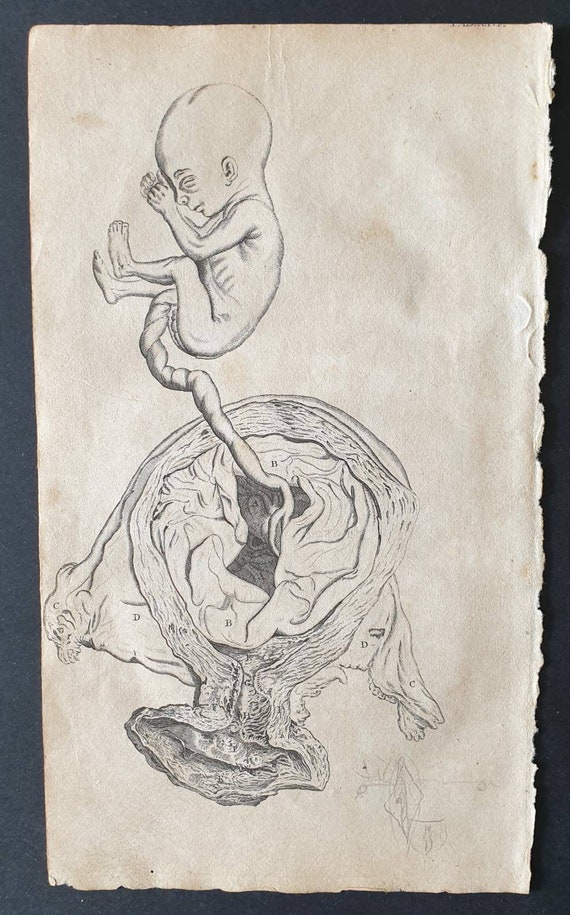 Original 1807 Andrew Fyfe Anatomical print - Gives a View of the Uterus and Foetus in the Fifth Month of Pregnancy