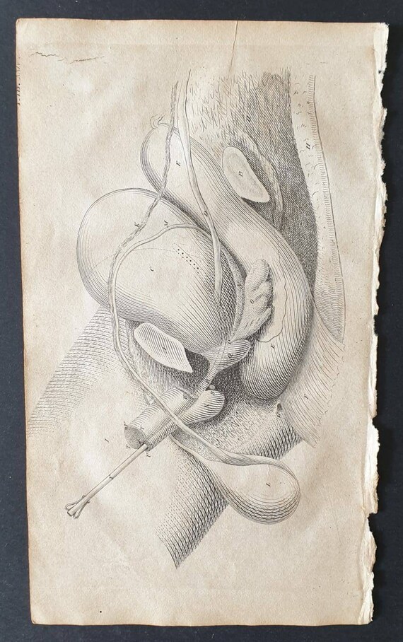 Original 1807 Andrew Fyfe Anatomical print - Gives a Side View of the Contents of the Male Pelvis