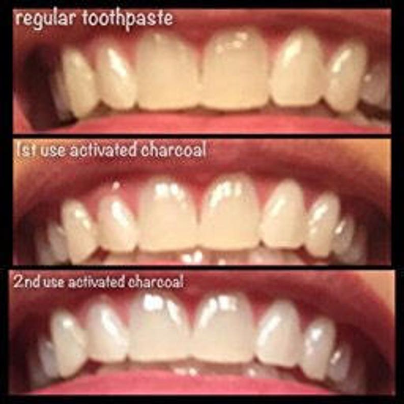 Tooth Cleaner... Activated Charcoal Teeth Whitening and Etsy