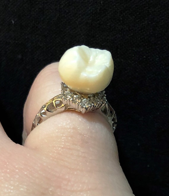 Human Tooth Ring Human Molar Ring Real Human Tooth Ring Etsy