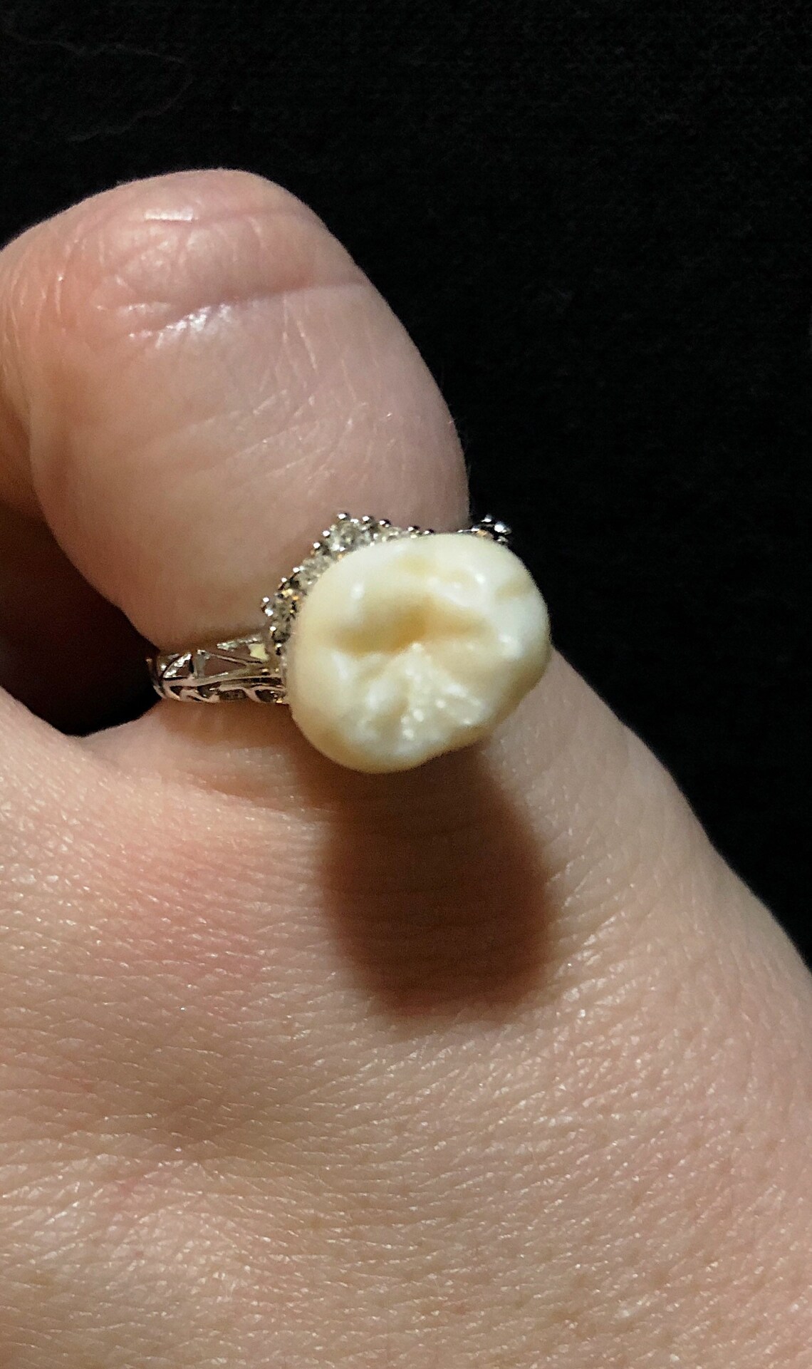 Human Tooth Ring Human Molar Ring Real Human Tooth Ring Etsy