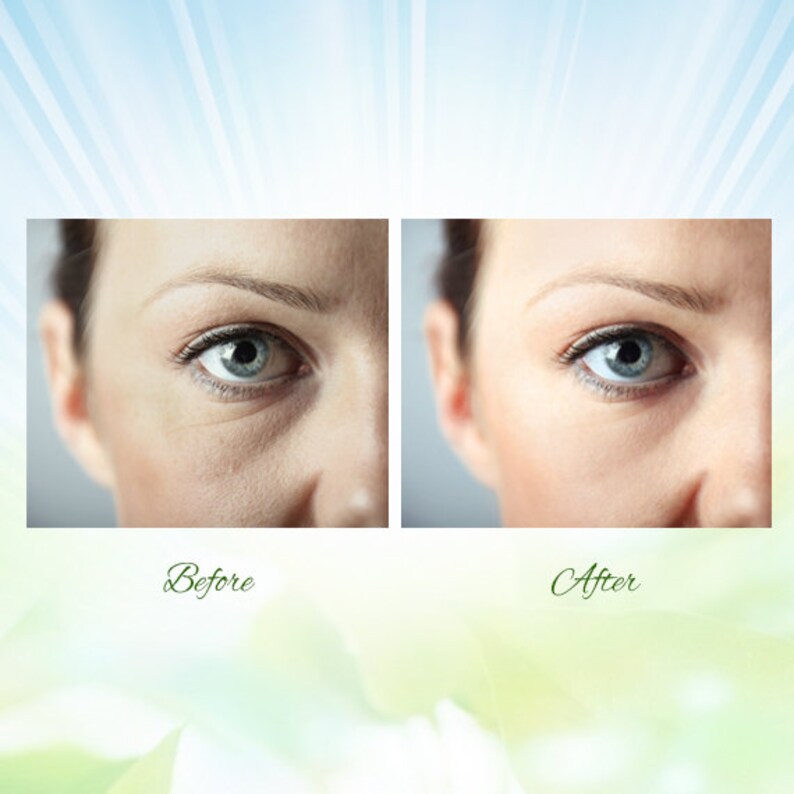 May include: A split image shows a woman's eye area before and after a treatment. The left side shows wrinkles and dark circles, while the right side shows smoother skin. The words "Before" and "After" are written in cursive.