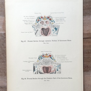 1906 Original Antique Human Anatomy, Anatomy print - Head, Medical illustration