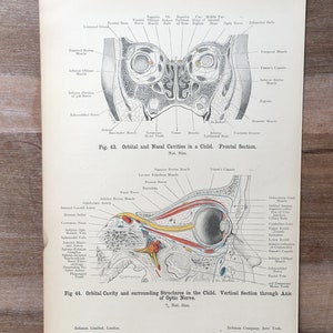 1906 Antique Medical print, Face print, Anatomy art engraving, Vintage Medical Print, Antique Medicine Print, Human Body Print